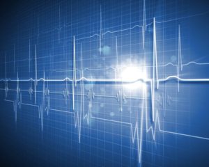 Illustration of a health heart rhythm Illustration of a health heart rhythm