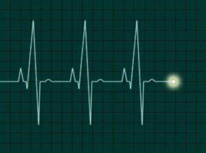 Heart rhythm from Electrocardiogram Machine