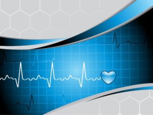 Illustration of a heart rhythm Illustration of a heart rhythm