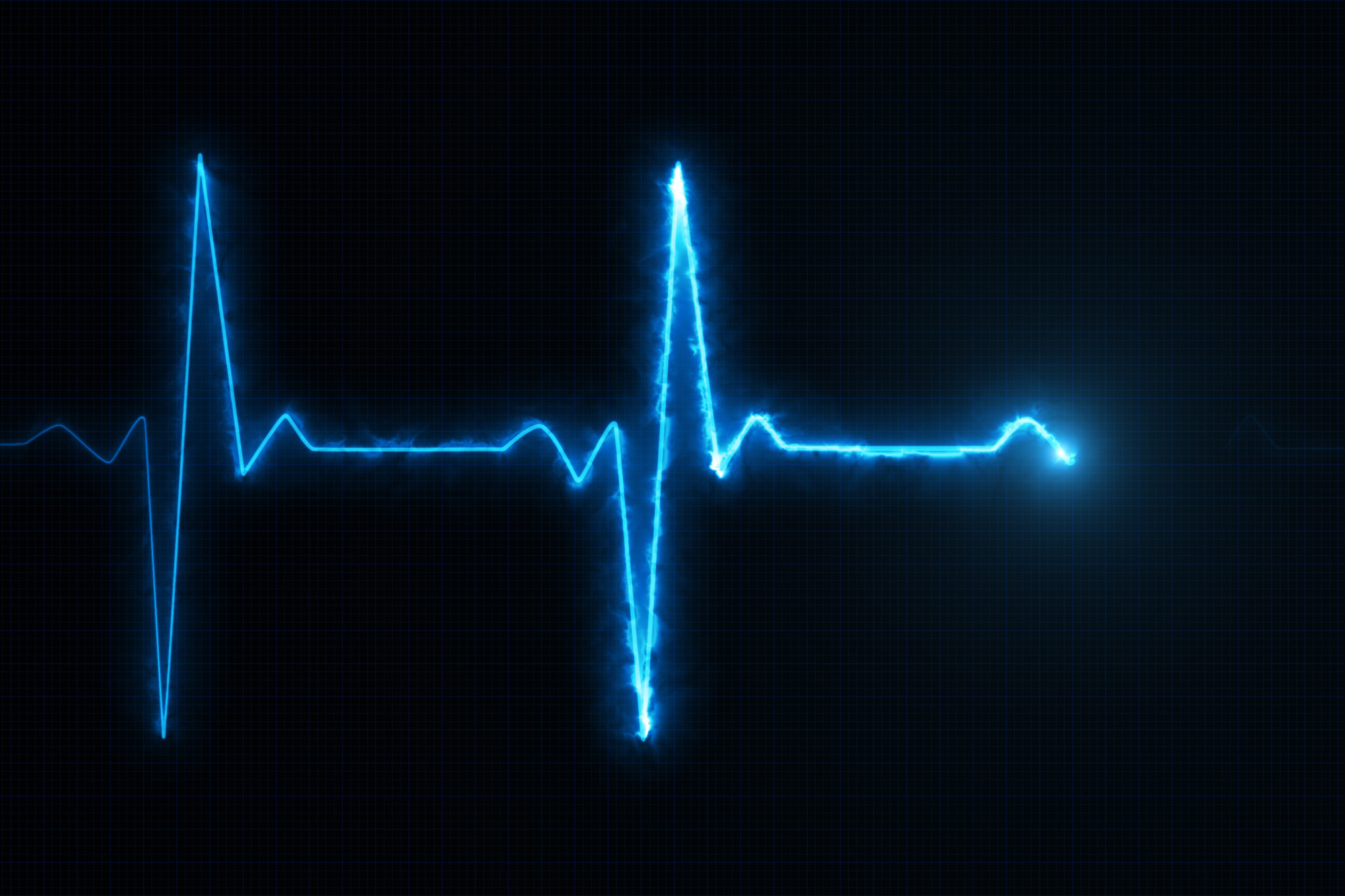 What Is an EKG Device and Why Your Hospital Needs One