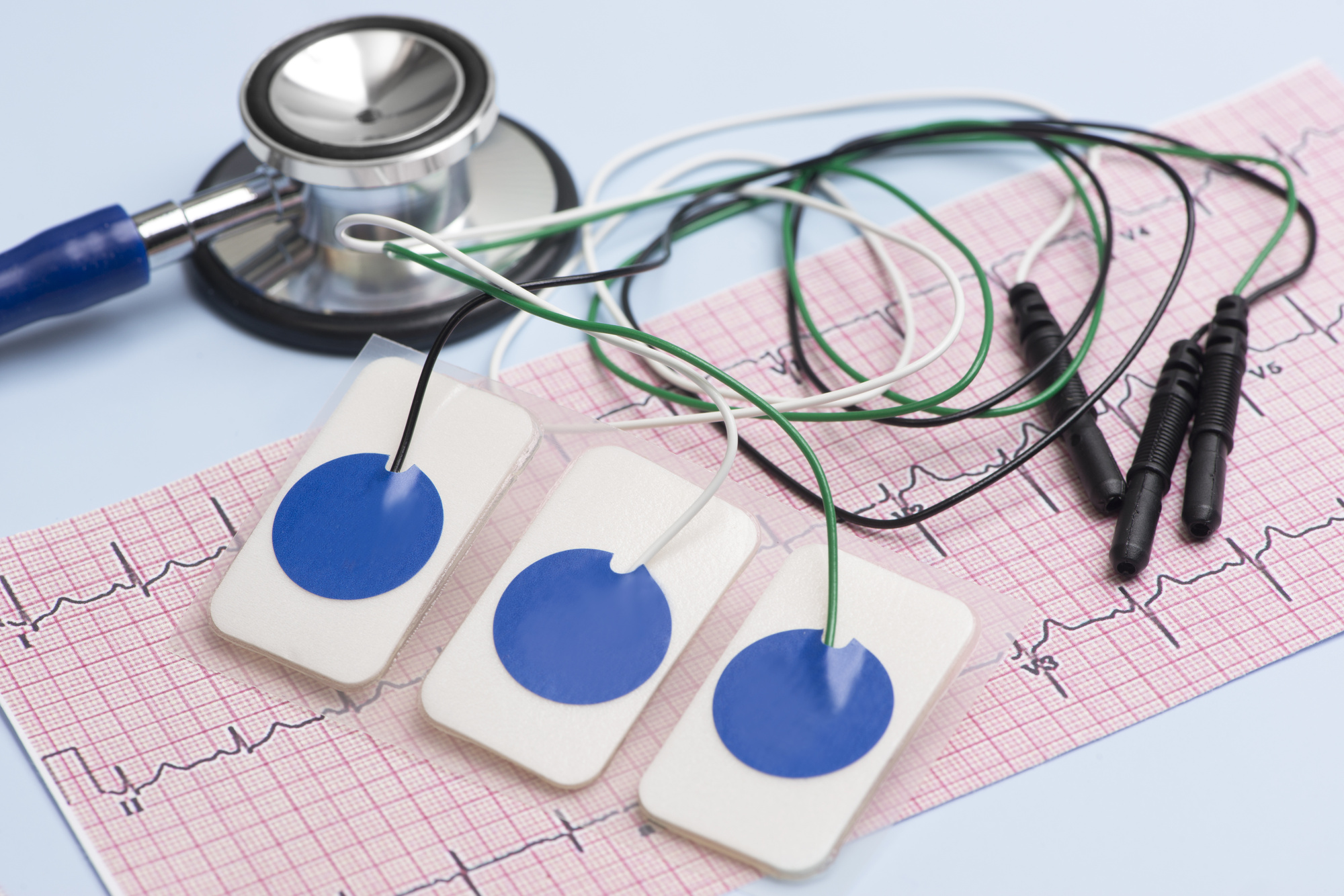 EKG Machine Buying Guide: What You Should Be Looking For in a New Machine